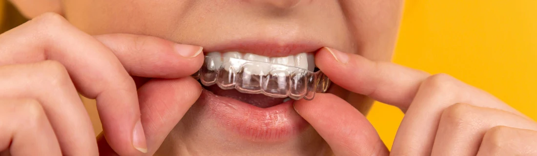 Woman Putting In Her Clear Aligner With a Yellow Wall Behind Her
