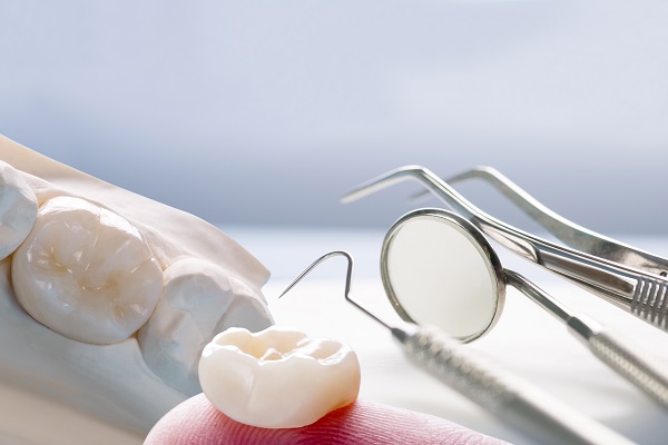 How Many Visits Does It Take To Get A Dental Crown?