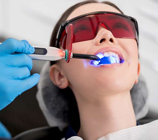 Bellevue Professional Teeth Whitening
